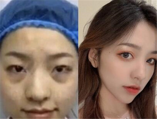 抖音网红刘思瑶nice整容被扒 真实的她长什么样子(图3)